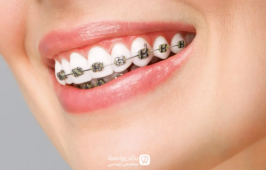 بهترین متخصص ارتودنسی میرداماد تهران و نحوه دریافت نوبت