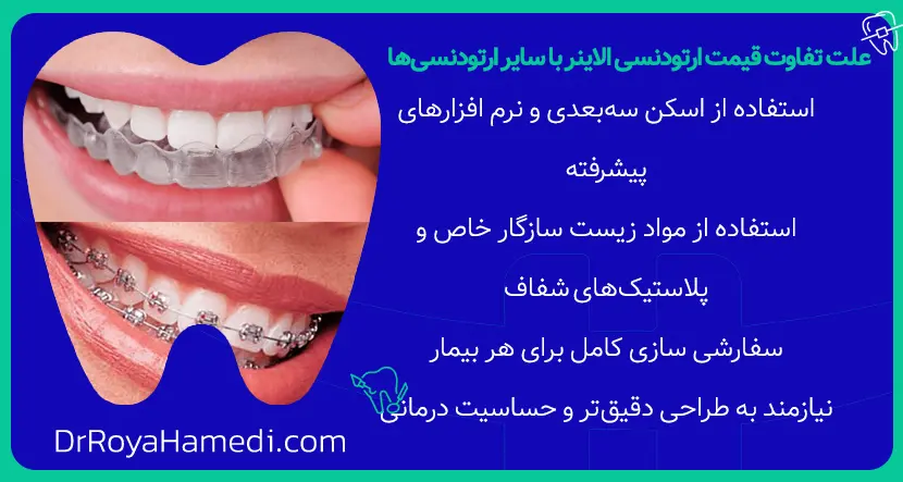 علت تفاوت قیمت ارتودنسی الاینر