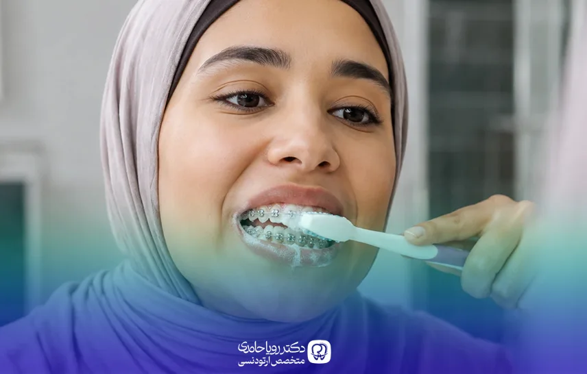 نحوه مراقبت از ارتودنسی دندان ثابت و متحرک