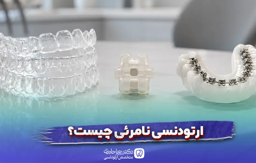 ارتودنسی نامرئی چیست؟ انواع و مزایا و معایب آن