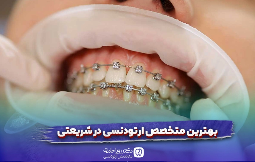 بهترین متخصص ارتودنسی در شریعتی تهران