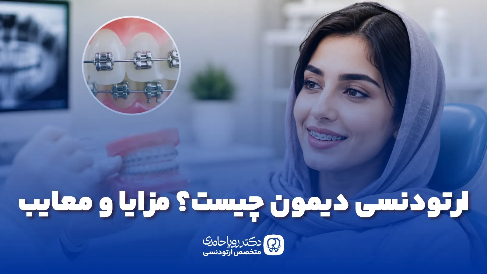 ارتودنسی دیمون