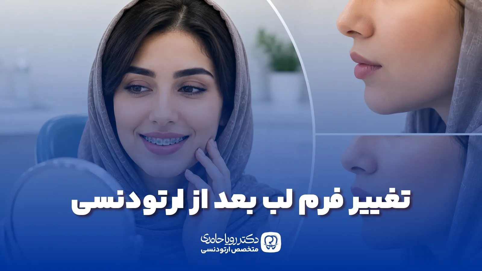 تغییر فرم لب بعد از ارتودنسی