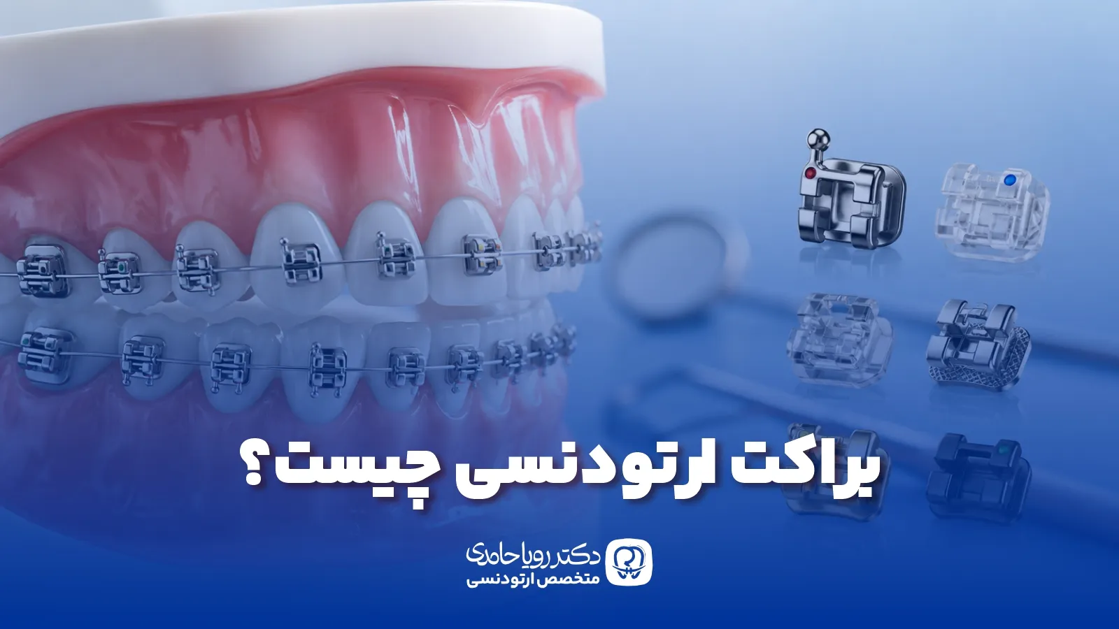 براکت ارتودنسی