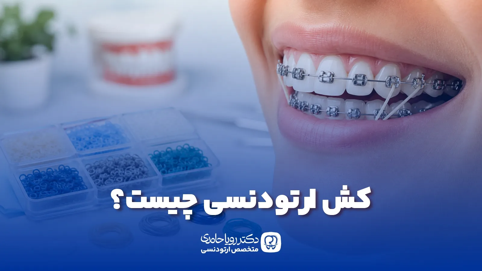 Orthodontic elastic 1