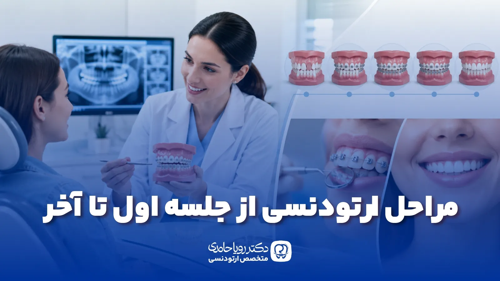 مراحل ارتودنسی