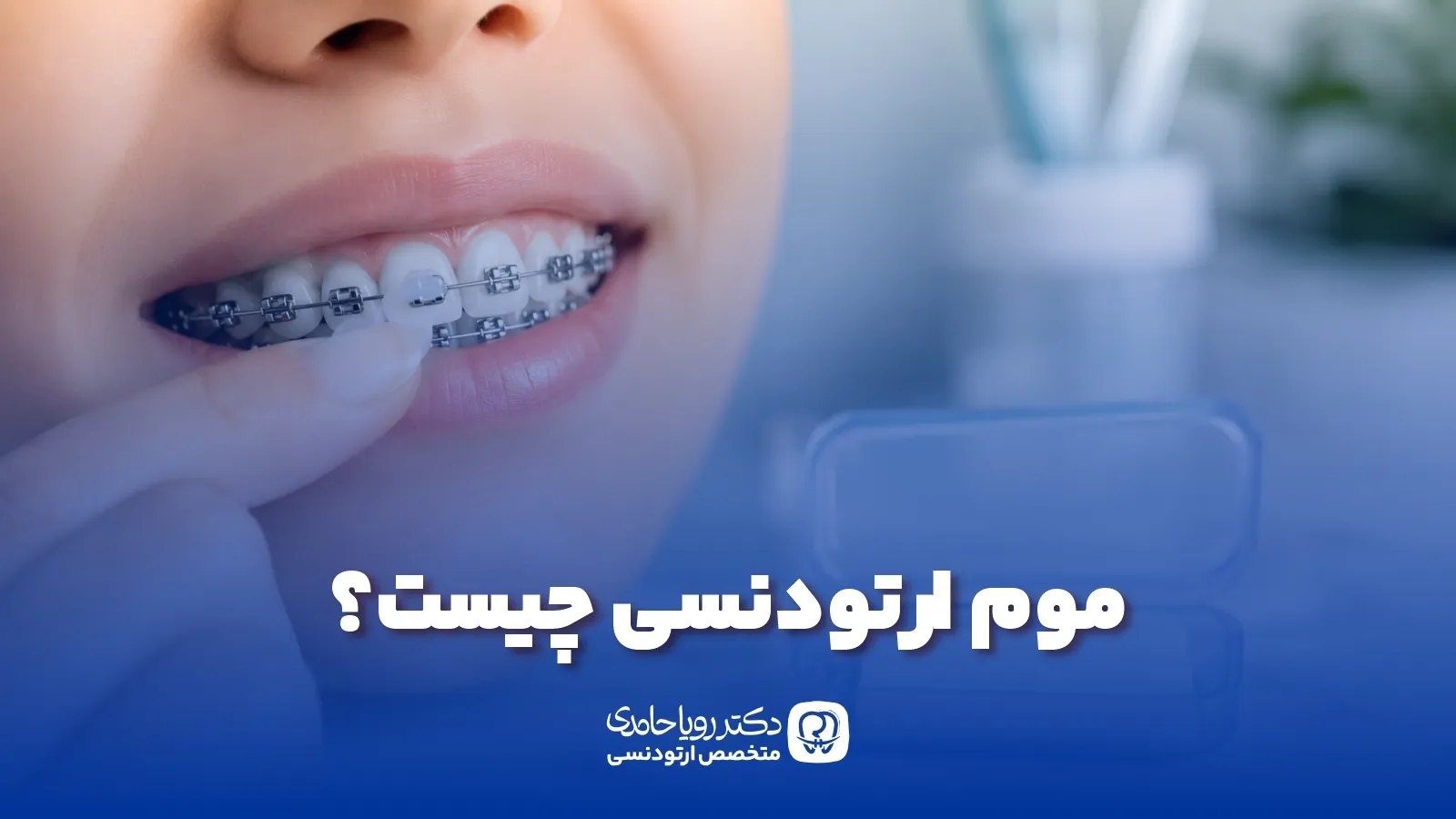 موم ارتودنسی