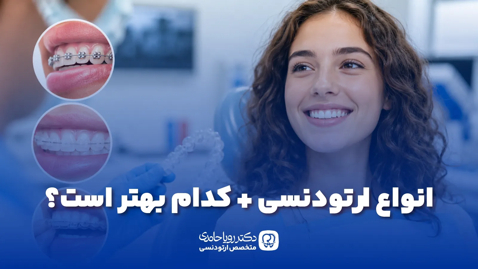 انواع ارتودنسی