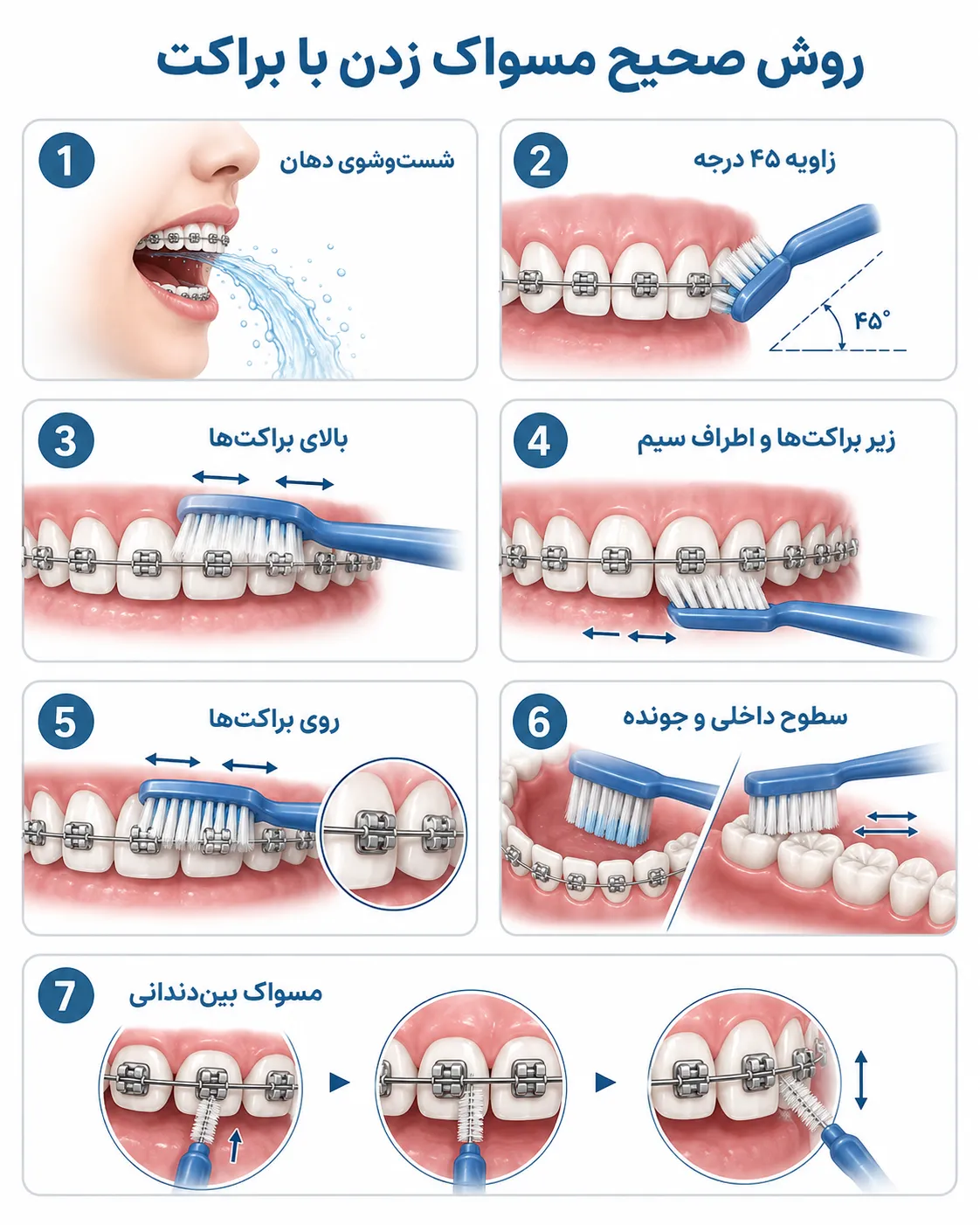 مسواک زدن با براکت