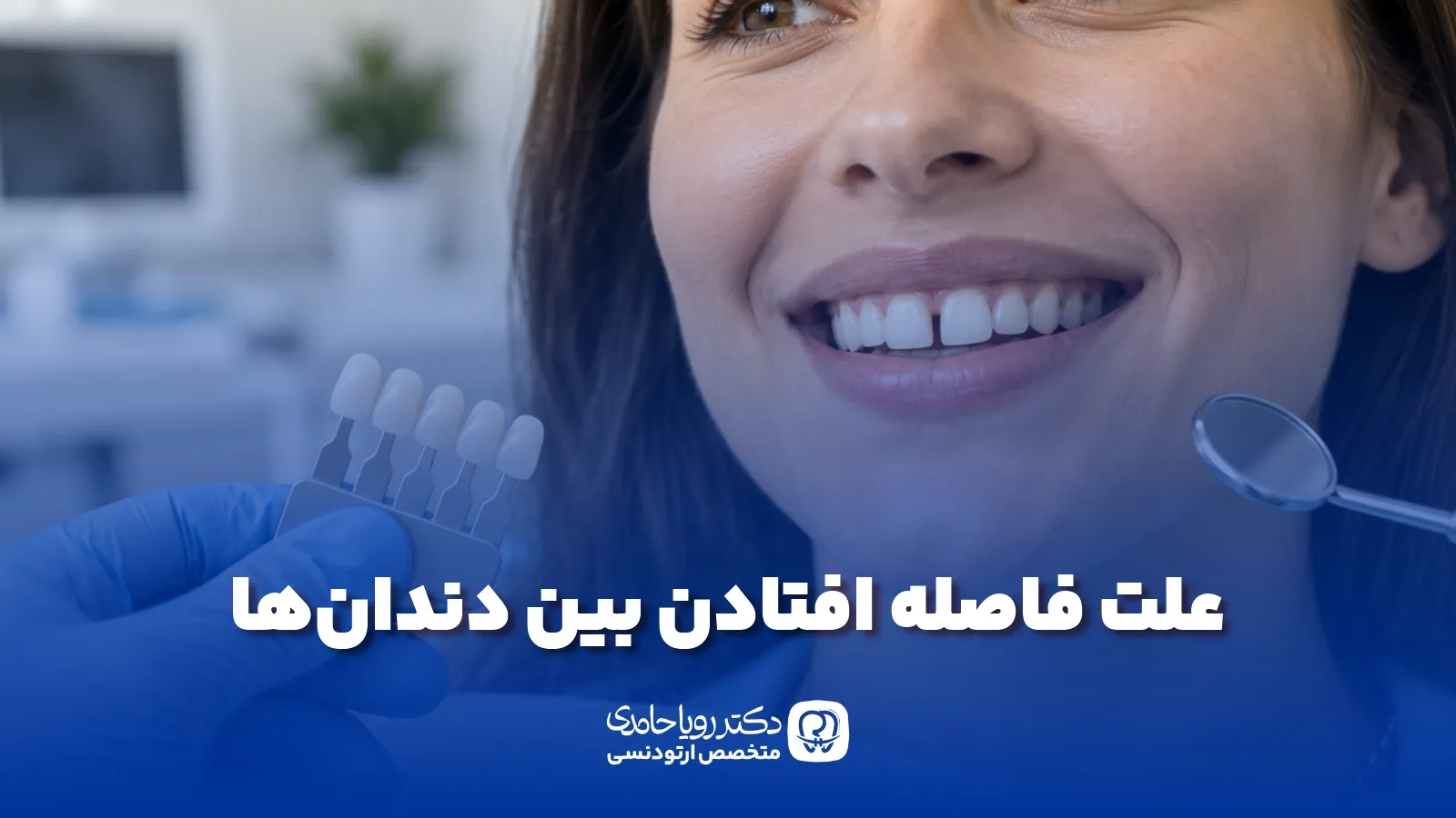 فاصله بین دو دندان