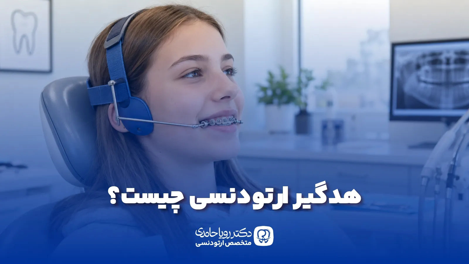 Orthodontic Headgear