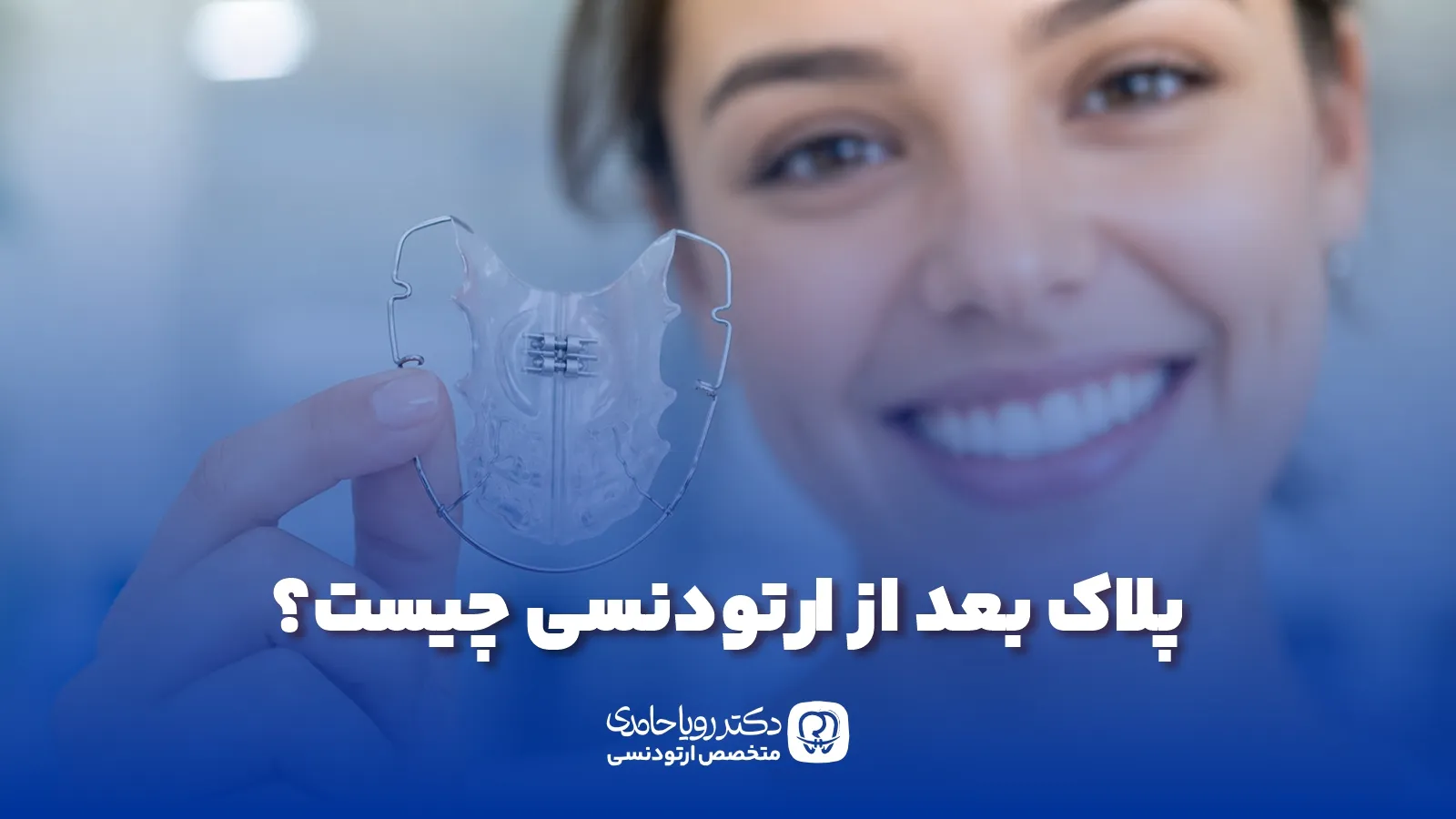 Retainers After Braces