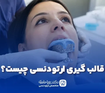 قالب گیری ارتودنسی
