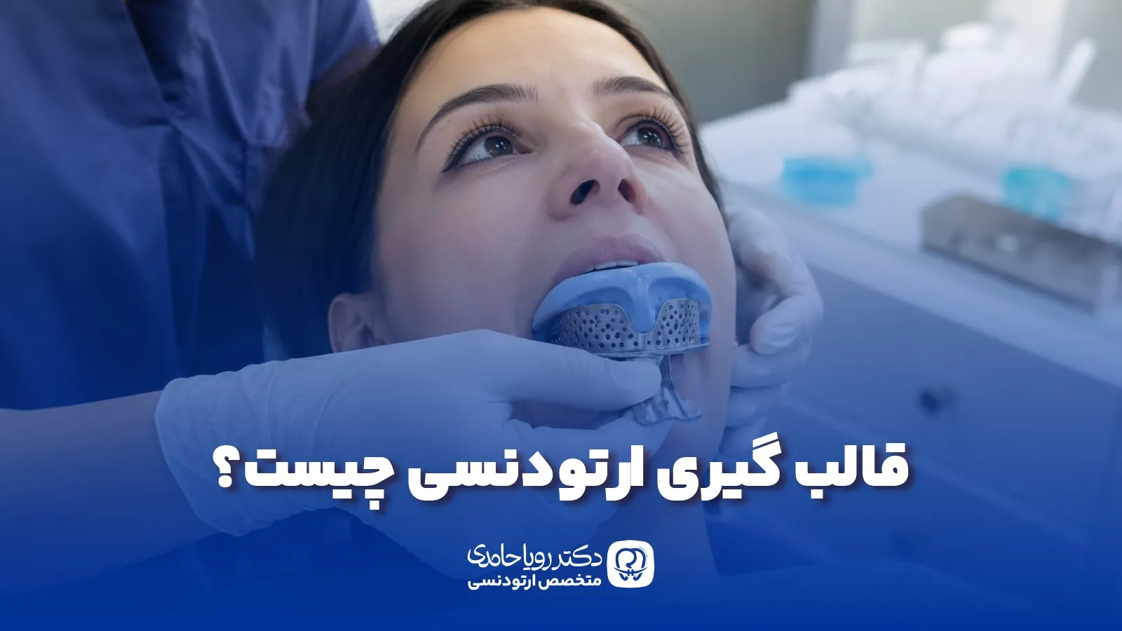 قالب گیری ارتودنسی