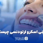 مینی اسکرو ارتودنسی