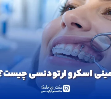 مینی اسکرو ارتودنسی